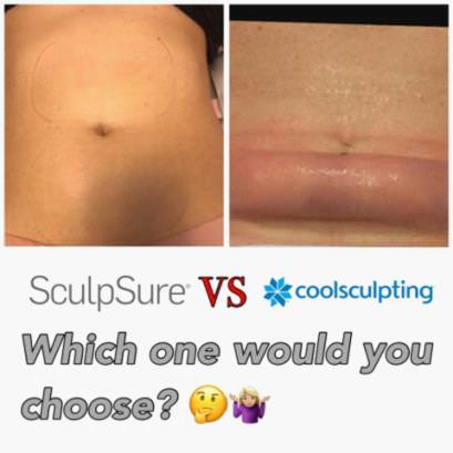 SculpSure vs CoolSculpting  Colen, Larry (norfolkplasticsurgerypc