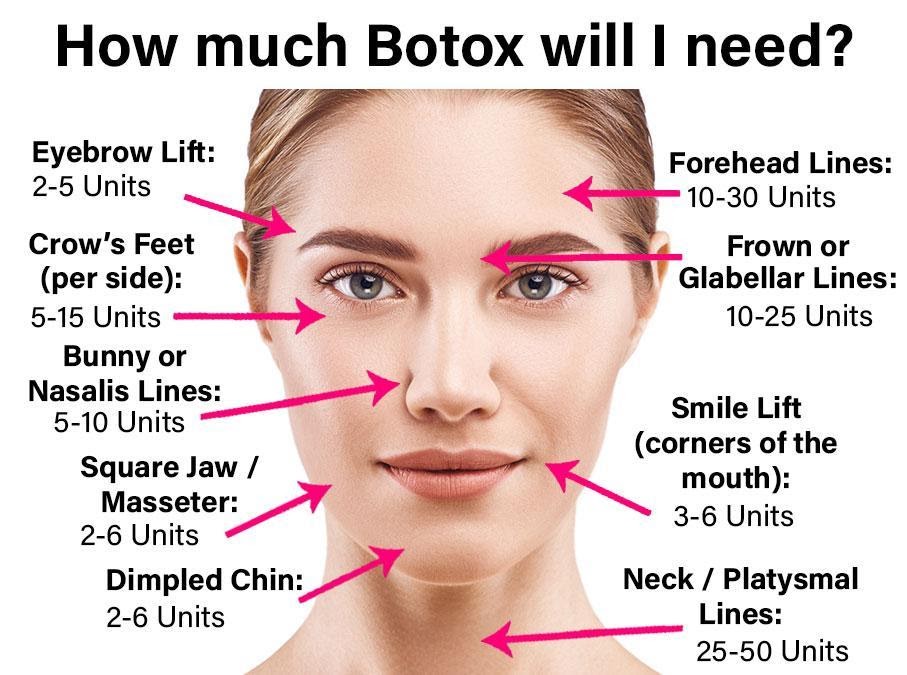 Botox Treatment Areas Infographic